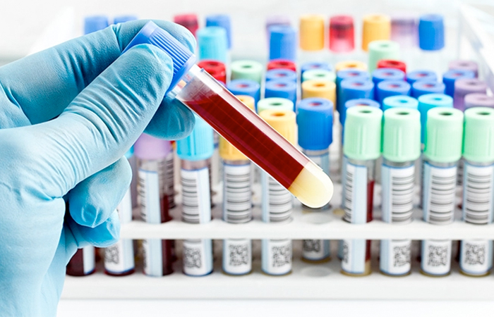Close-up of gloved hand holding a blood sample test tube in a lab with rows of color-coded test tubes, illustrating precision in medical research, relevant to Impinj's commitment to innovative technology and privacy policy.